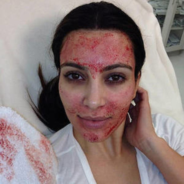10 Amazing "Natural" Beauty Treatments You Won't Believe Exist Hero Image