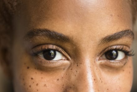 I Tried Radio-Frequency For Dark Circles — Here's What Happened