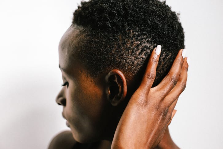 Are You Mistaking This Hair Care Woe For Dandruff? Here's What It Could Be