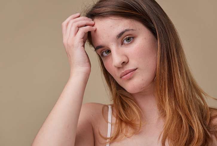 3 Expert-Approved At-Home Treatments To Smooth The Forehead