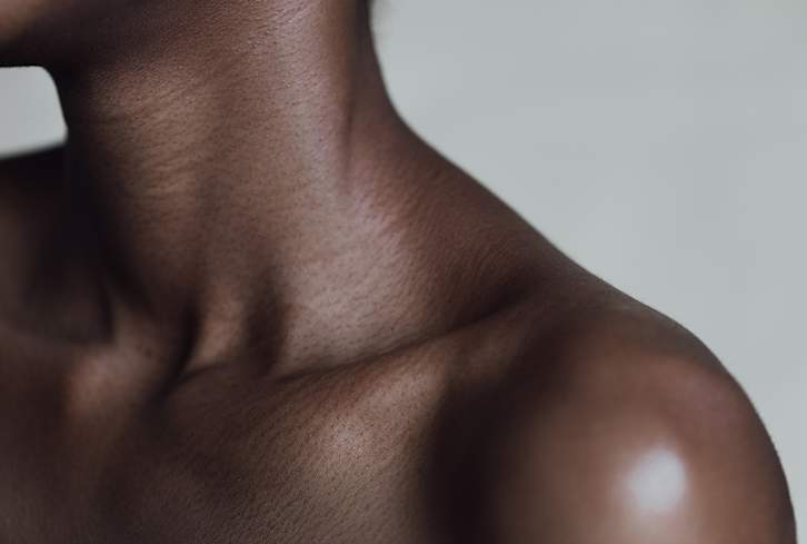 These Bumps Are Commonly Mistaken For Acne, But Here's What They Really Are