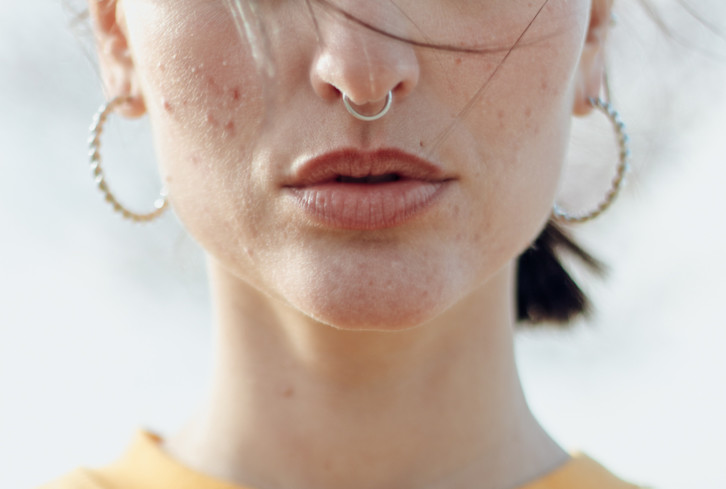 I've Had A 15-Year Struggle With My Skin—This Product Changed Everything*