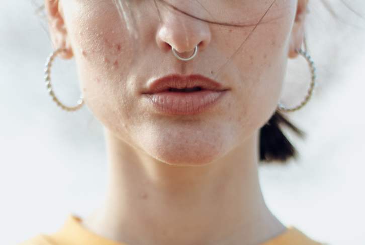 I've Had A 15-Year Struggle With My Skin—This Product Changed Everything*