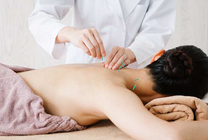 5 Benefits Of Acupuncture For Brain Health (Plus, What Each Type Does)