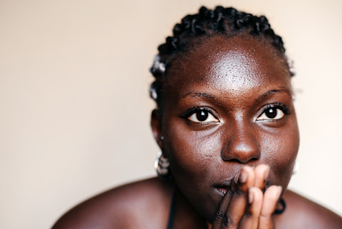 black woman with acne