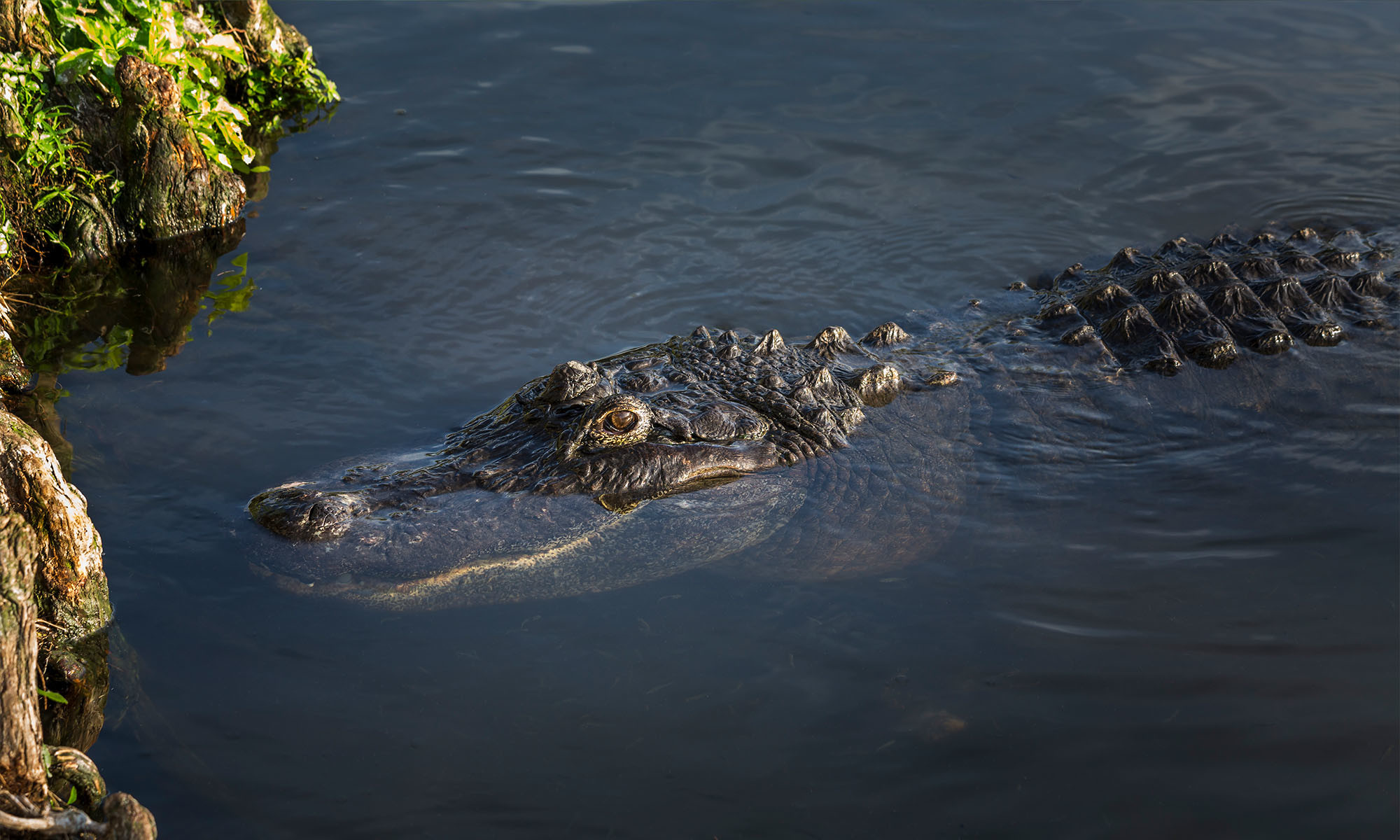 What Is Alligator Skin Disease?