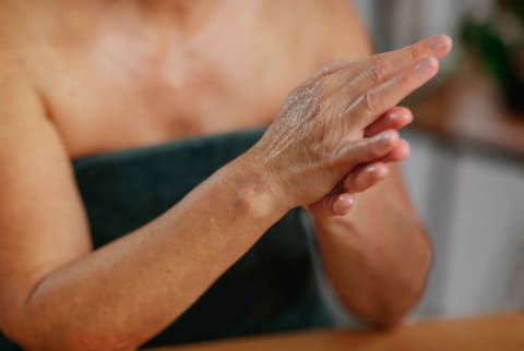 Woman rubs lotion into dry, crepey skin on her hands