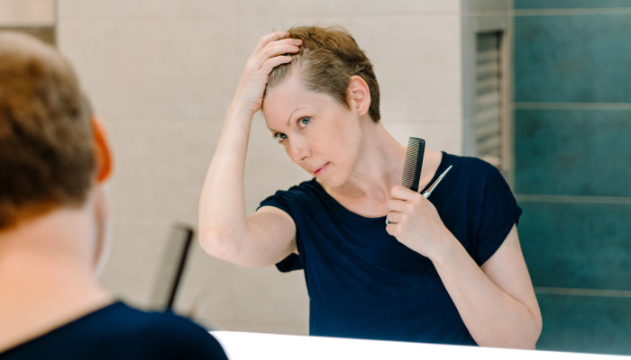 Treating A Receding Hairline 6 Expert Tips For Men Women