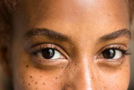 I Tried Radio-Frequency For Dark Circles — Here's What Happened