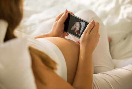 Yay, You're Pregnant! Here's Why You Should Think Twice Before Posting Your Sonogram
