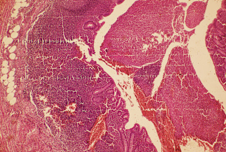 Ever Heard Of Digestive Plaque? It Could Be Ruining Your Gut Health