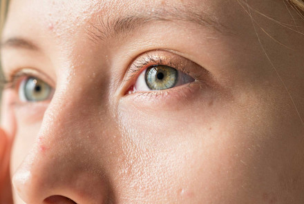 Read article: Dry Eye After LASIK or Vision Correction? What No One Warns You About