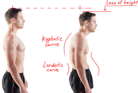 4 Simple Steps To Get Great Posture (Video)