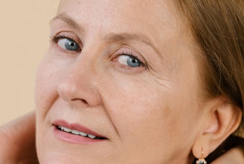 woman with eye wrinkles and glowing skin