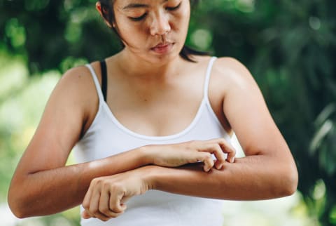 Woman Scratching Her Arm