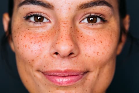 Cloes up of women's face and freckles
