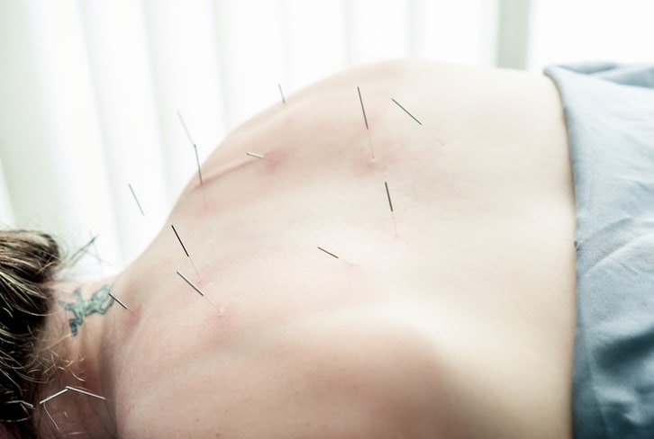 Why I Prescribe Acupuncture: A Cardiologist Explains