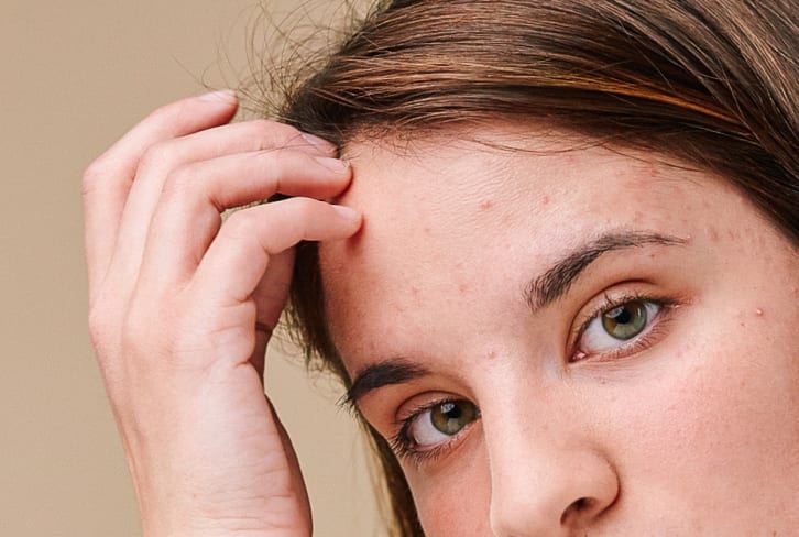 Do You Pick At Your Scalp? Here's What Experts Want You To Know