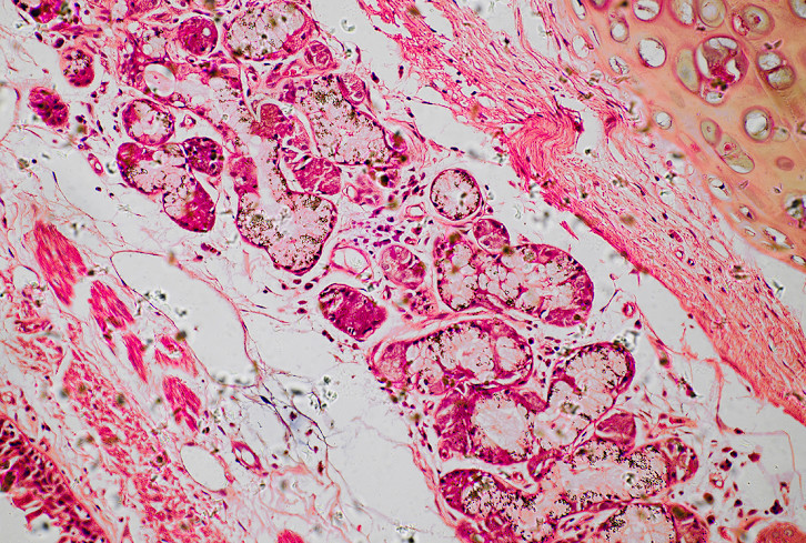 Why Microbiome Health Is More Important Than Ever (And How To Get Yours Back On Track)