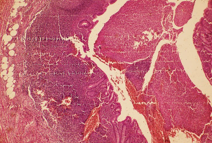Ever Heard Of Digestive Plaque? It Could Be Ruining Your Gut Health