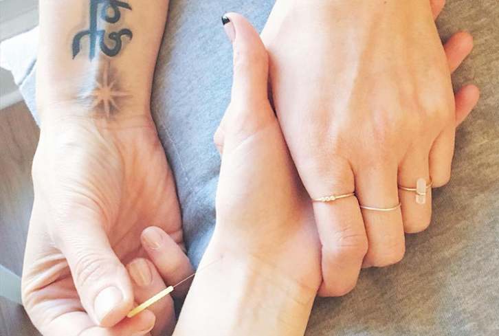 5 Acupuncture Myths We All Need To Stop Believing: A Doctor Explains