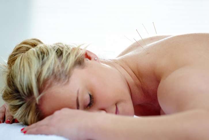 Can Acupuncture Help Strengthen Your Pelvic Floor?