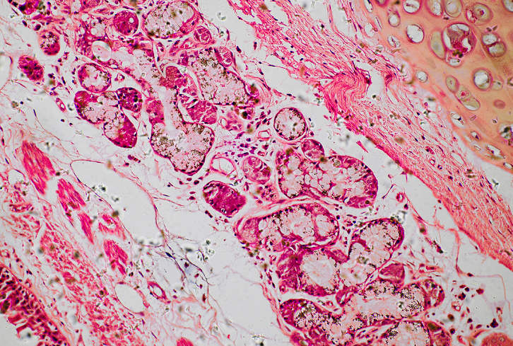 Why Microbiome Health Is More Important Than Ever (And How To Get Yours Back On Track)