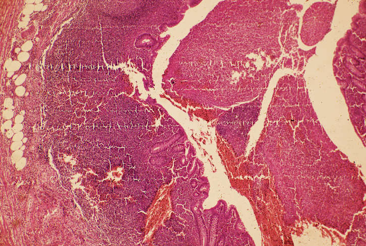 Ever Heard Of Digestive Plaque? It Could Be Ruining Your Gut Health