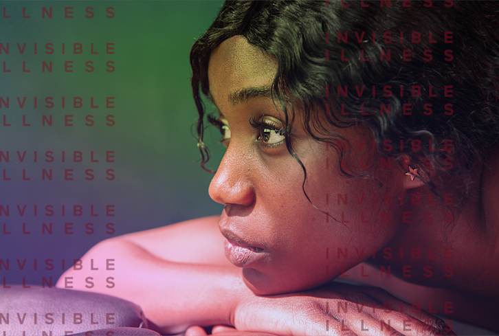 After Years Of Joint Pain & Rashes, I Was Diagnosed With This Autoimmune Disease