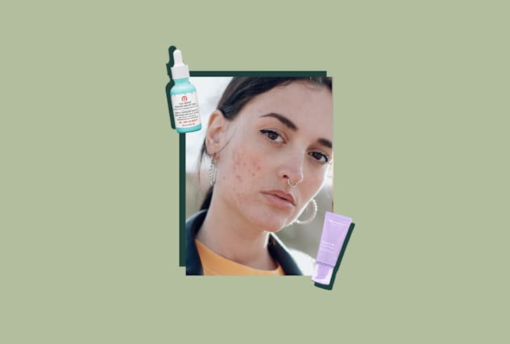 Here's Exactly What You're Looking For To Fade Dark Spots Quickly