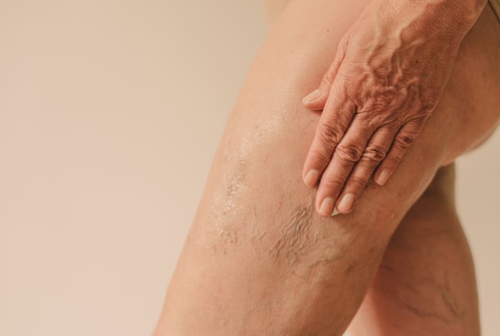 How To Treat & Prevent Crepey Skin Anywhere On The Body