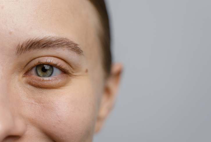 This Area Of The Face Is The First To Experience Wrinkles—How To Erase Them