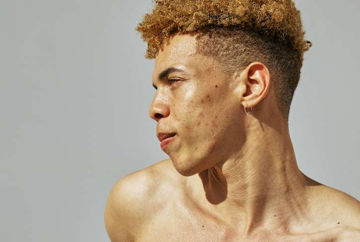The Surprising Reason You Have Uneven Skin Texture + How To Deal