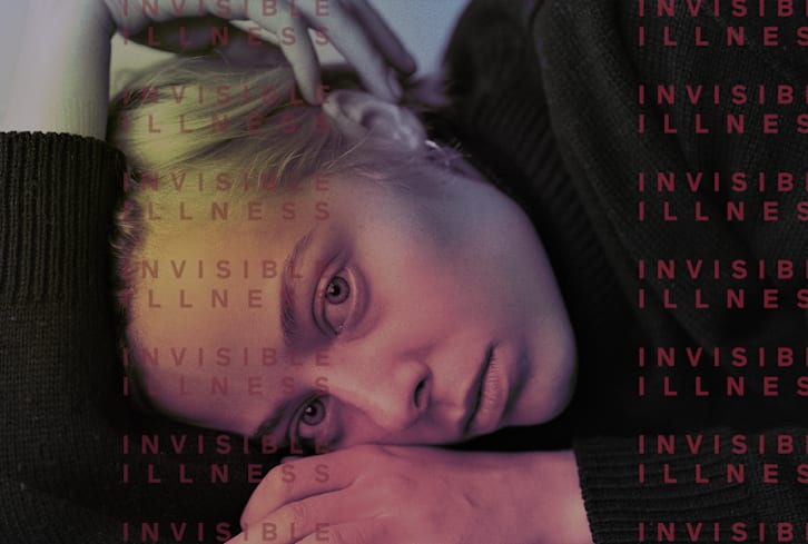 My Parents Thought I Had A Brain Tumor — Then I Got This Misunderstood Diagnosis