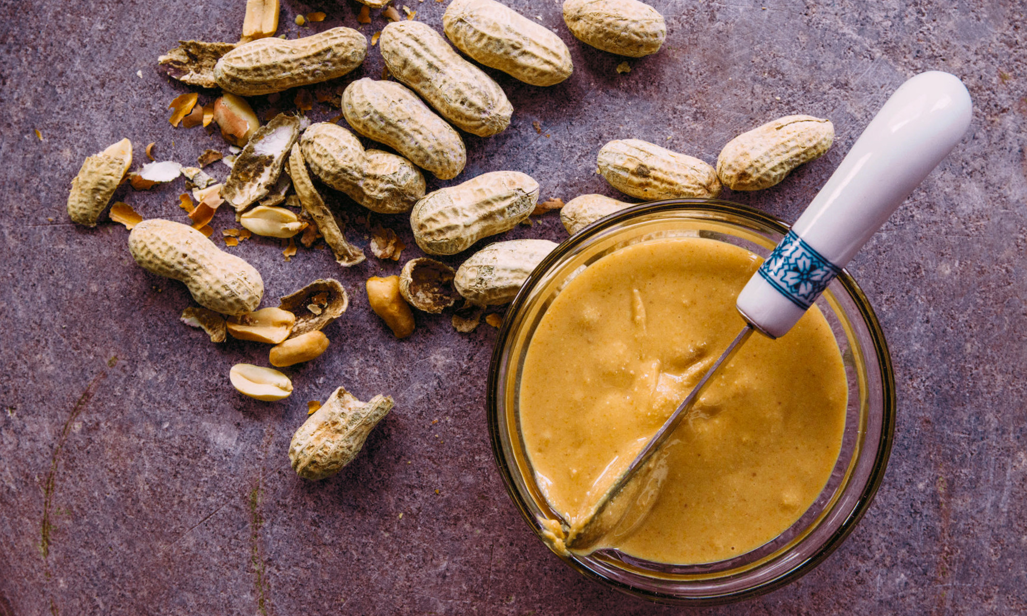 Eating This Nut Daily May Reduce Your Risk Of Developing Diabetes