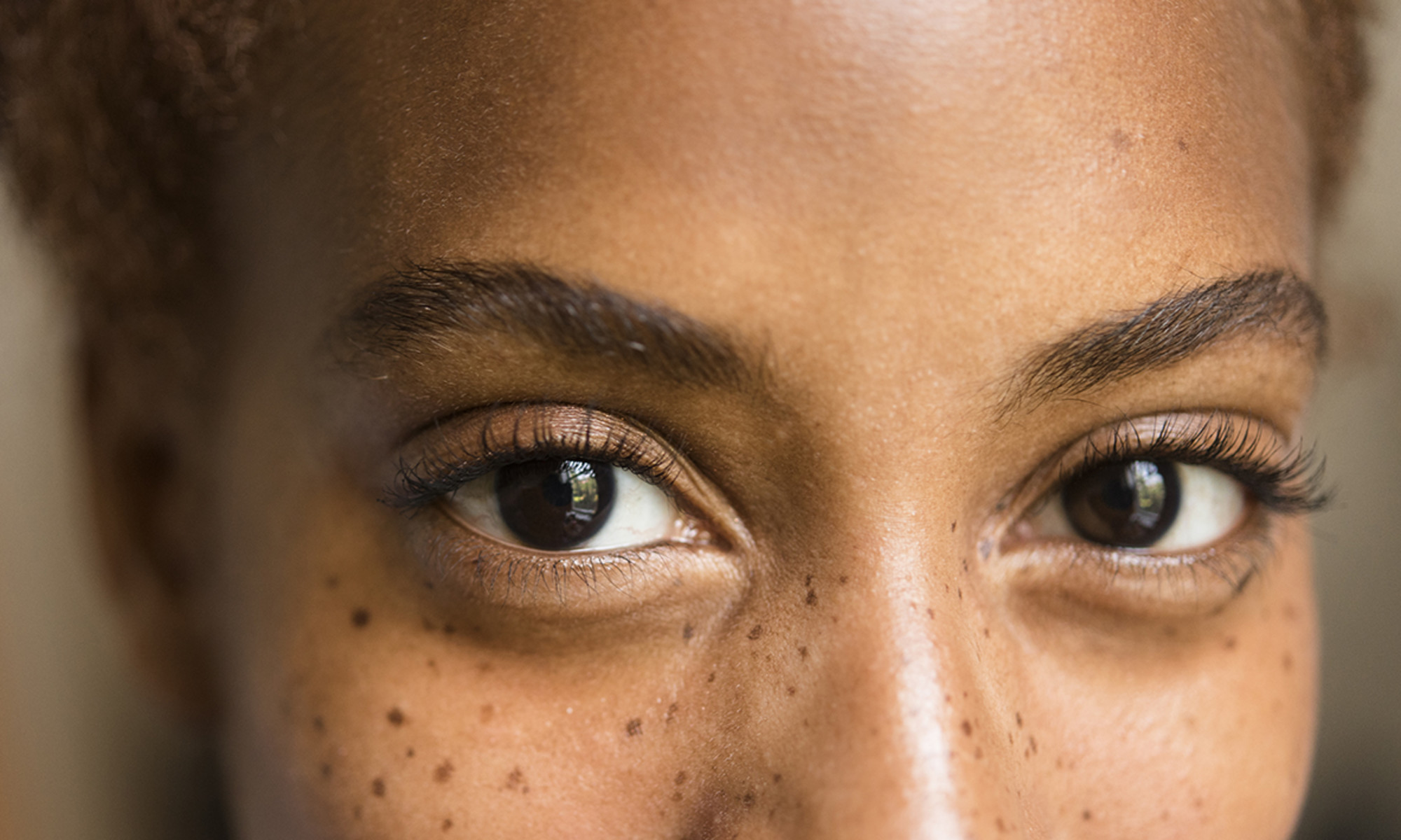 I've always wondered: why do we get dark circles under our eyes?