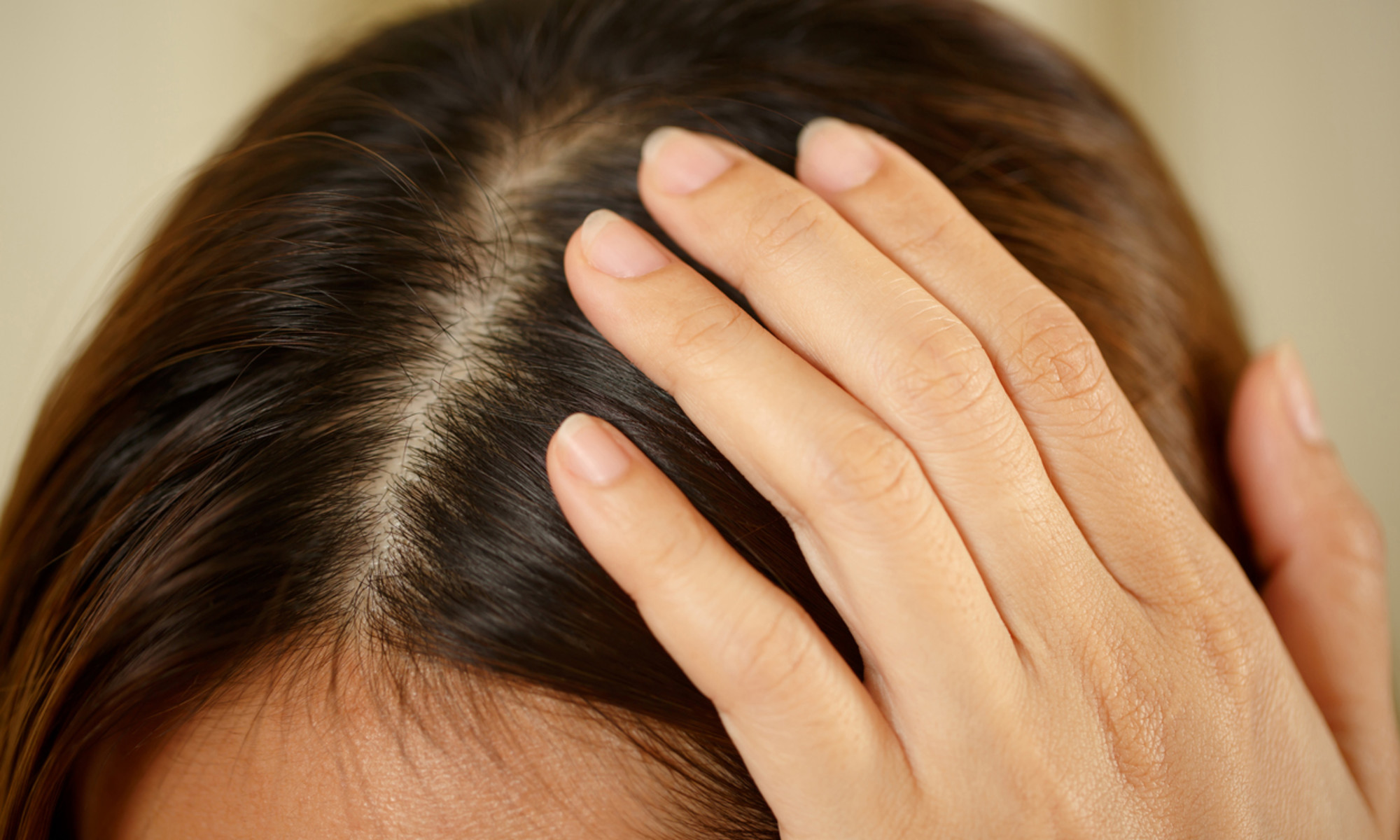 How To Get Rid Of Itchy Scalp Naturally? Try These 7 Home Remedies To Treat  And Tips To Prevent It | Onlymyhealth
