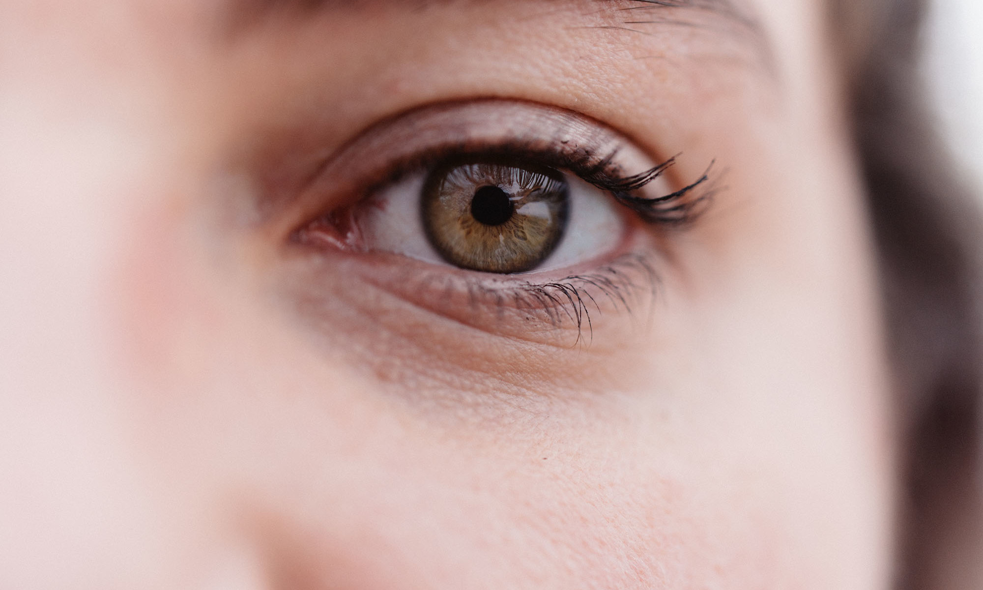 Everything You Need To Know About Dry Eyelids—From Causes To Remedies + FAQ