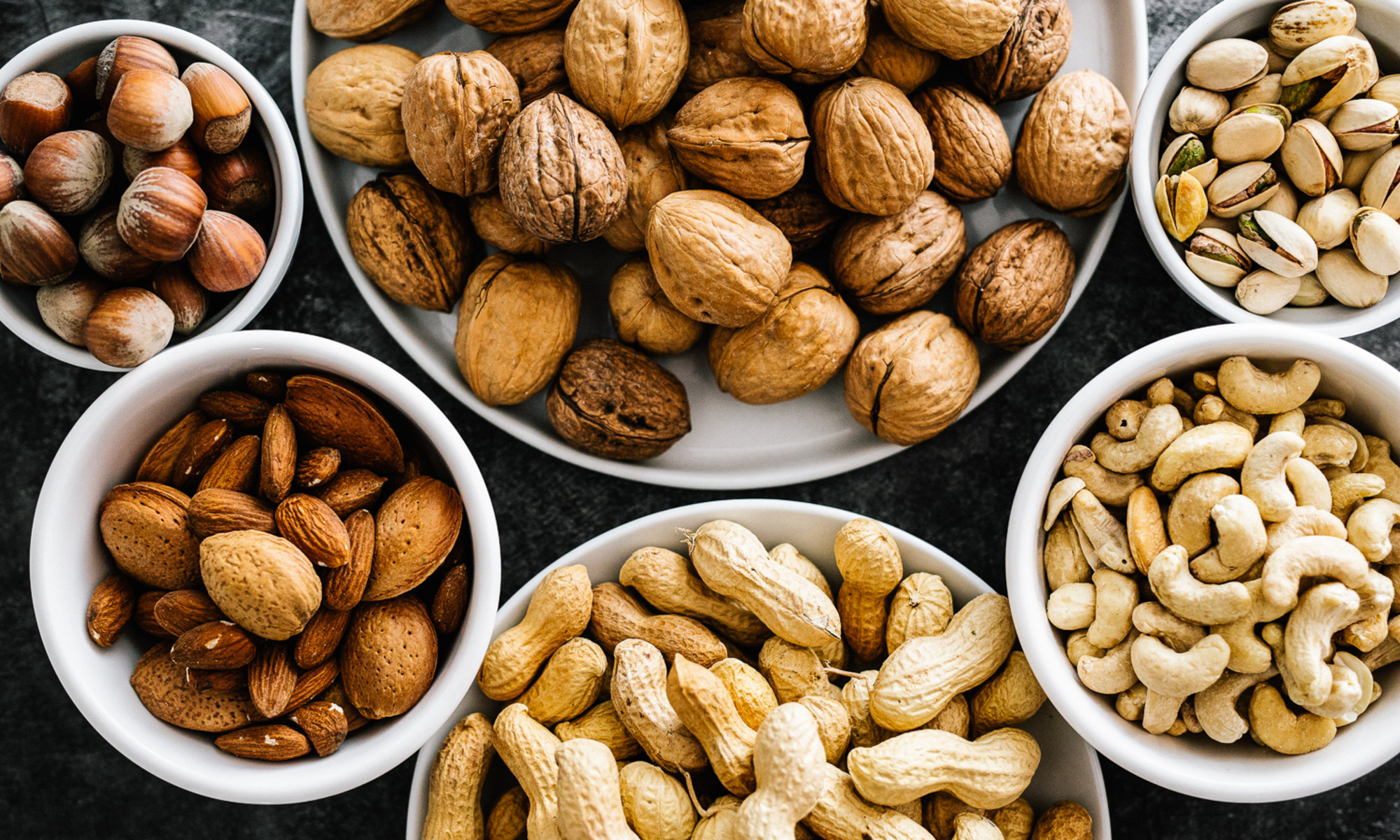 Five Super Healthy Nuts to Eat, Why They Are So Good For You