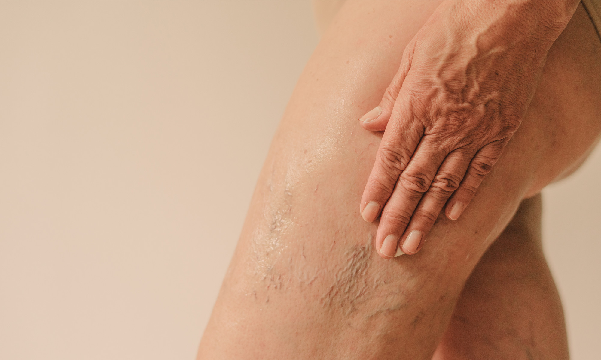3 Ingredients That Ease The Appearance Of Crepey Skin 3 Ingredients That Ease The Appearance Of Crepey Skin