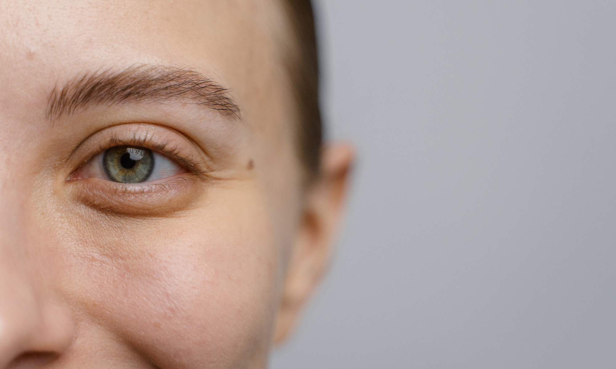 This Area Of The Face Is The First To Experience Wrinkles—How To Erase Them