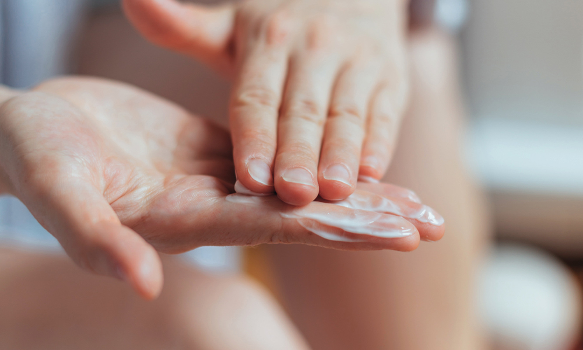 3 Ways To Treat Stubborn Dark Spots On The Hands 3 Ways To Treat Stubborn Dark Spots On The Hands