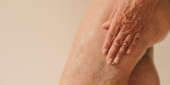 Image of How To Treat & Prevent Crepey Skin Anywhere On The Body