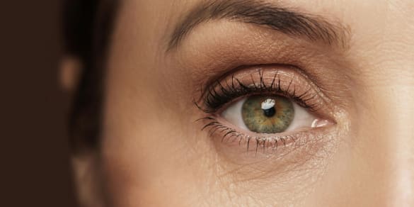 Image of What Your Under-Eye Wrinkles Are Telling You (And How To Smooth Them)