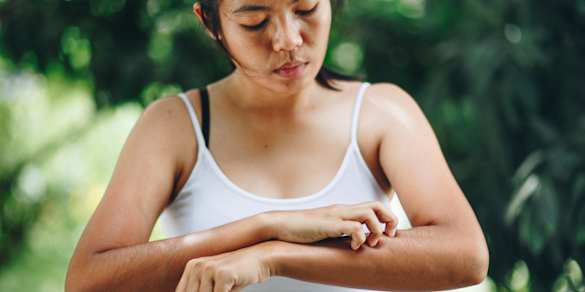 Image of Stay Away From These 4 Ingredients If Your Skin Is Inflamed Or Itchy