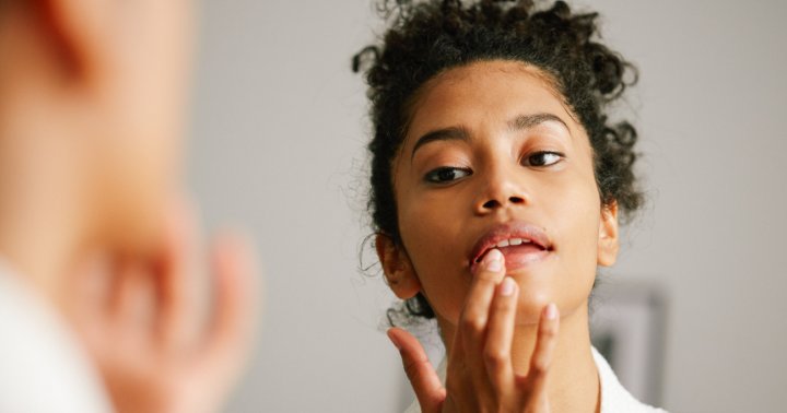 What Is Lip Eczema & How To Treat Its Symptoms Naturally | mindbodygreen
