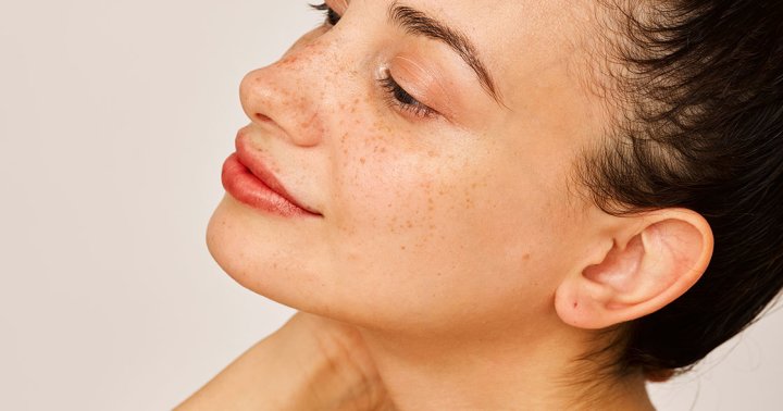 How To Cycle Your Skin Care Products If You Have Rosacea, From a Dermatologist
