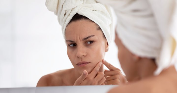 The Sneaky Sign You May Have Gone Too Far With Your Retinol
