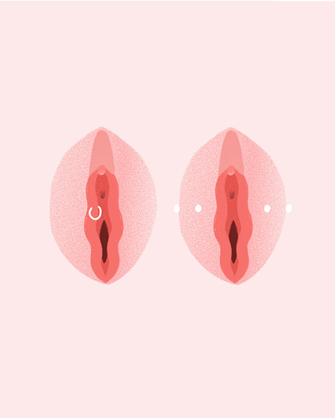 Image showing two types of labia piercings. Image showing two types of labia piercings.