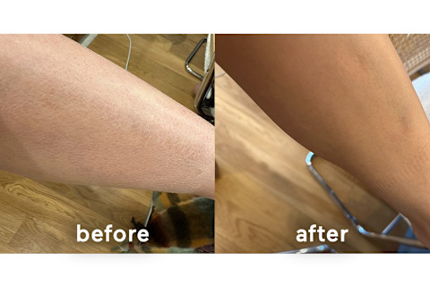 Jamie before and after using Marin's cream